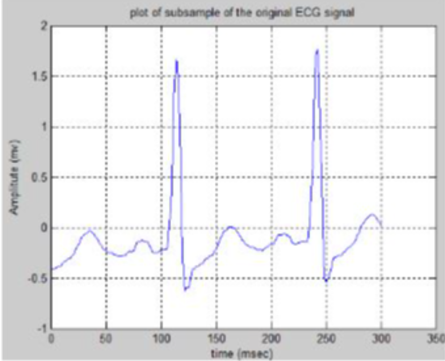 SIGNAL ANALYSIS USING MATLAB, KPR Institute Engineering and Technology ...