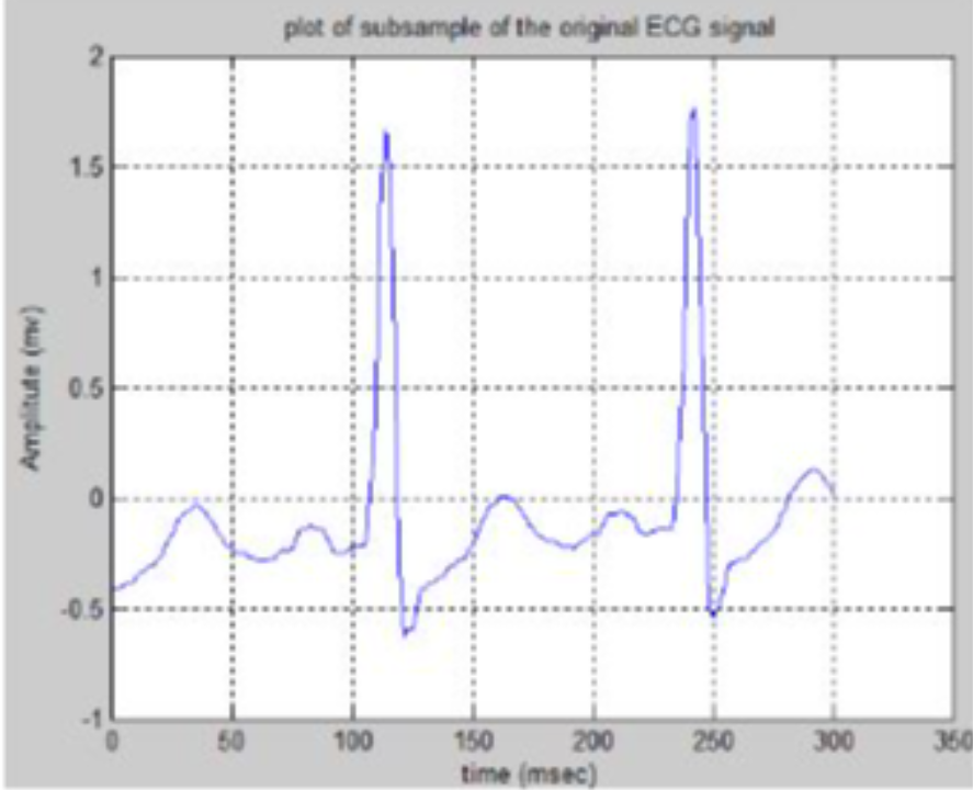 SIGNAL ANALYSIS USING MATLAB